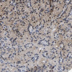 ZNF449 Antibody, Novus Biologicals:Antibodies:Primary Antibodies